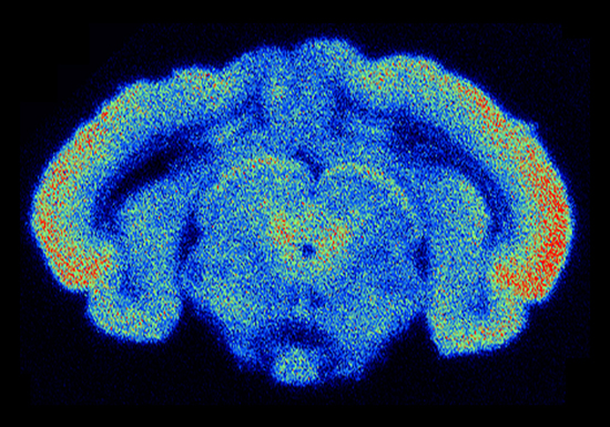beta imager