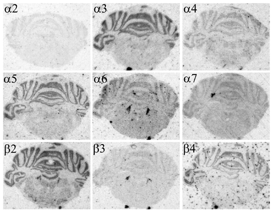 rhombencephalon