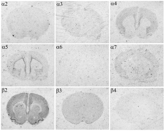telencephalon